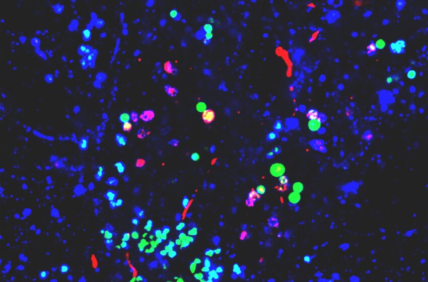  Les nanoplastiques favorisent les conditions de la maladie de Parkinson dans divers modèles de laboratoire, selon une étude
