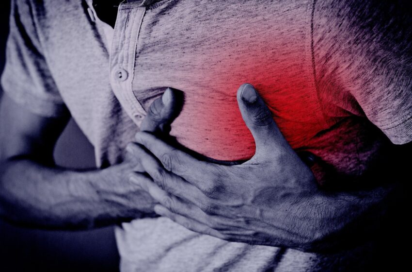  Les stents cardiaques peuvent offrir une alternative aux analgésiques thoraciques pour les patients angineux