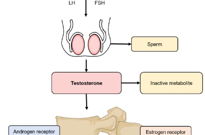  Une baisse du taux de testostérone est corrélée à des taux plus élevés d’arthrose de manière non dose-dépendante
