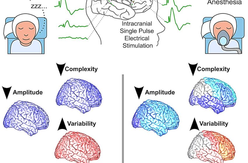  Une étude dévoile l’engagement de différents réseaux corticaux alors que les humains sont inconscients