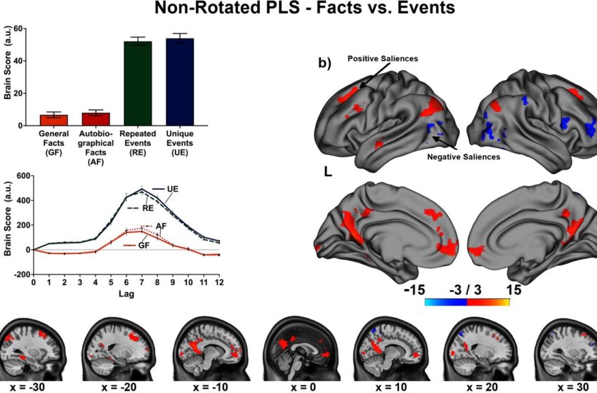 Une étude identifie comment le cerveau gère différents types de récupération de mémoire