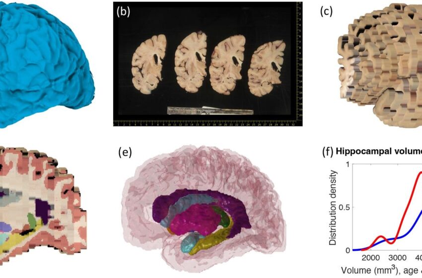  De nouveaux outils informatiques peuvent reconstruire le cerveau en 3D à partir de photos de biobanques