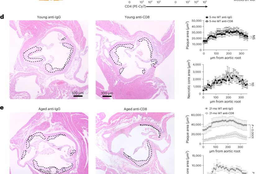 Les lymphocytes T CD8 mémoire favorisent l’accumulation de plaque pathogène dans les artères chez les souris âgées : étude