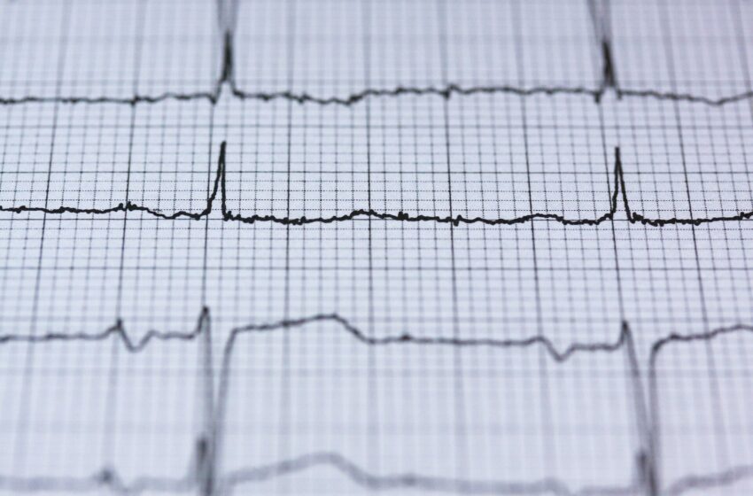  Les montres intelligentes peuvent détecter des rythmes cardiaques anormaux chez les enfants, selon une étude