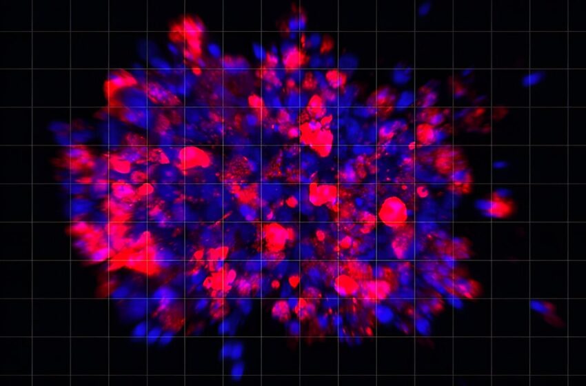  Les scientifiques utilisent un modèle organoïde pour identifier un nouveau traitement potentiel contre le cancer du pancréas