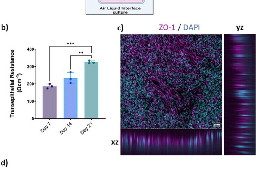  Une étude montre que l'infection au COVID-19 modifie la transcription génétique des cellules de la muqueuse olfactive dans la maladie d'Alzheimer