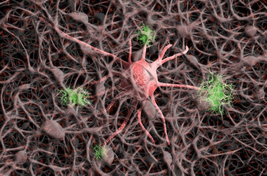  Des variantes de la protéine d'échafaudage synaptique PPFIA3 découvertes sont à l'origine d'un nouveau trouble neurodéveloppemental syndromique