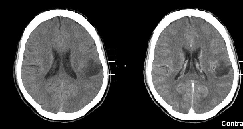  L’équipe de recherche établit un cadre pour améliorer les diagnostics d’imagerie des tumeurs cérébrales