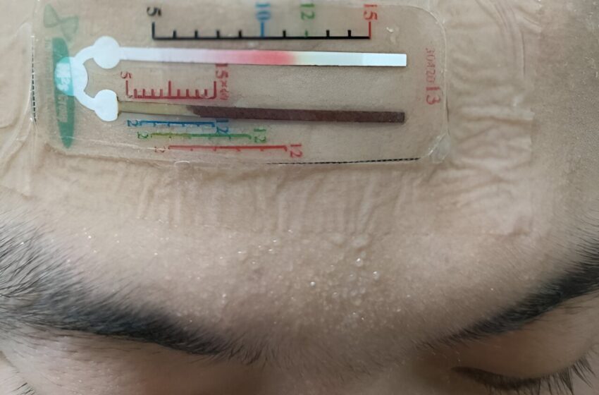  Un capteur à deux canaux mesure la concentration de biomarqueurs dans la sueur