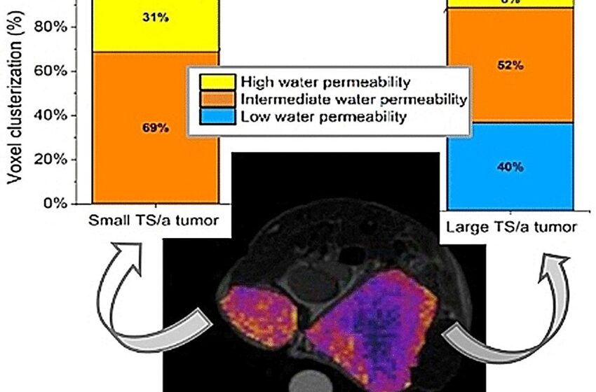 Une méthode basée sur l'IRM détecte l'échange d'eau dans les cellules tumorales pour mesurer leur malignité