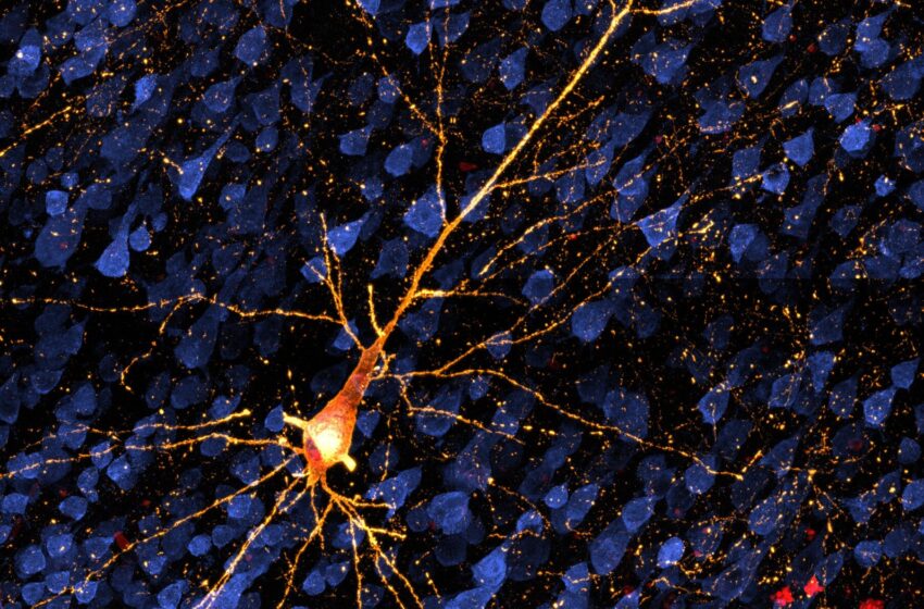  De nouvelles recherches suggèrent la possibilité de tester la maladie d’Alzheimer à un stade précoce