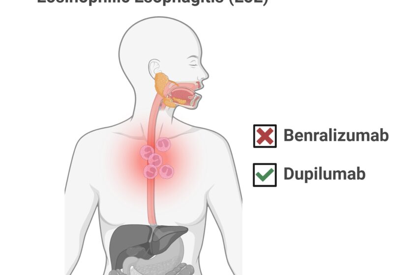  Deux études montrent des progrès mitigés contre l’œsophagite à éosinophiles