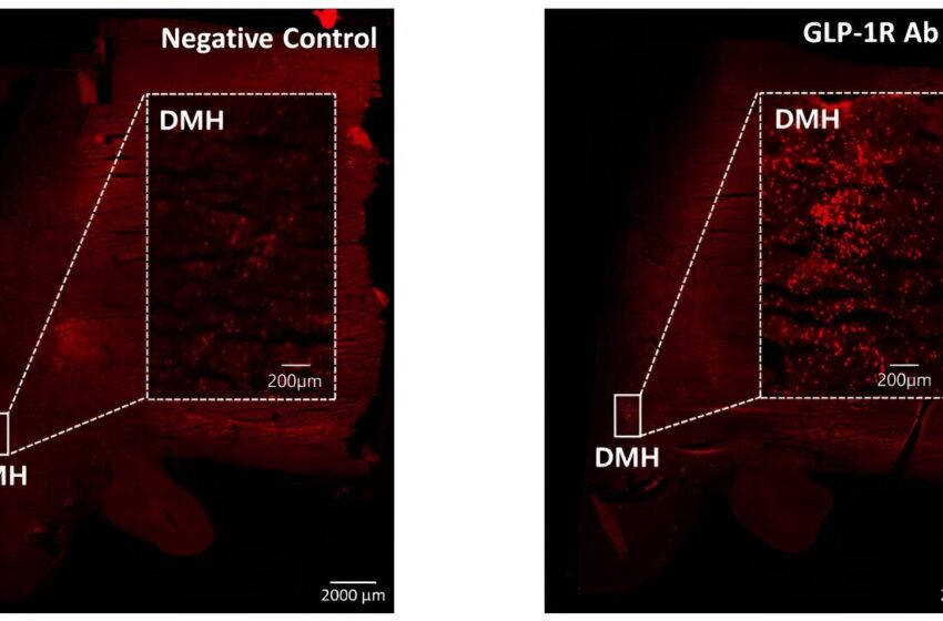  Deux groupes de neurones liés à la sensation de satiété ont été identifiés : l’un pour la satiété avant le repas et l’autre pour la satiété après le repas