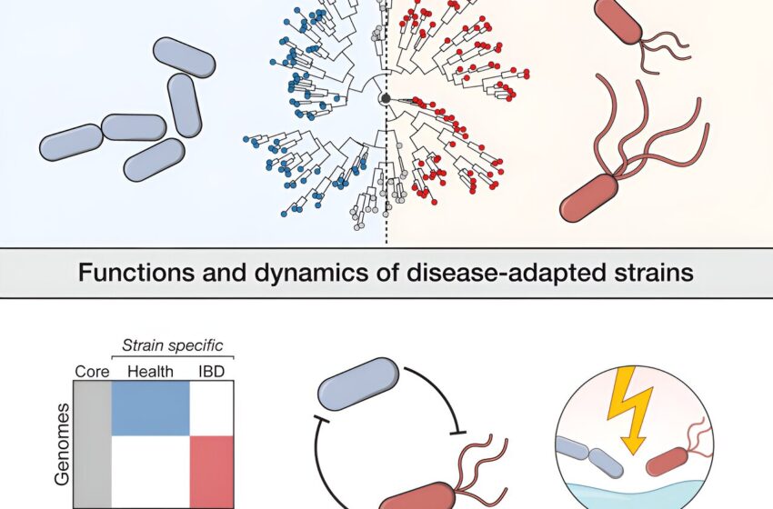  La recherche identifie des souches bactériennes intestinales liées aux maladies inflammatoires de l’intestin