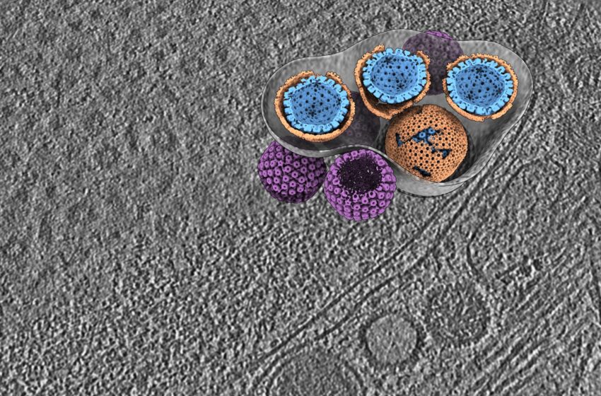 Mécanisme clé de sortie de l’herpèsvirus découvert, offrant une nouvelle cible pour les thérapies antivirales