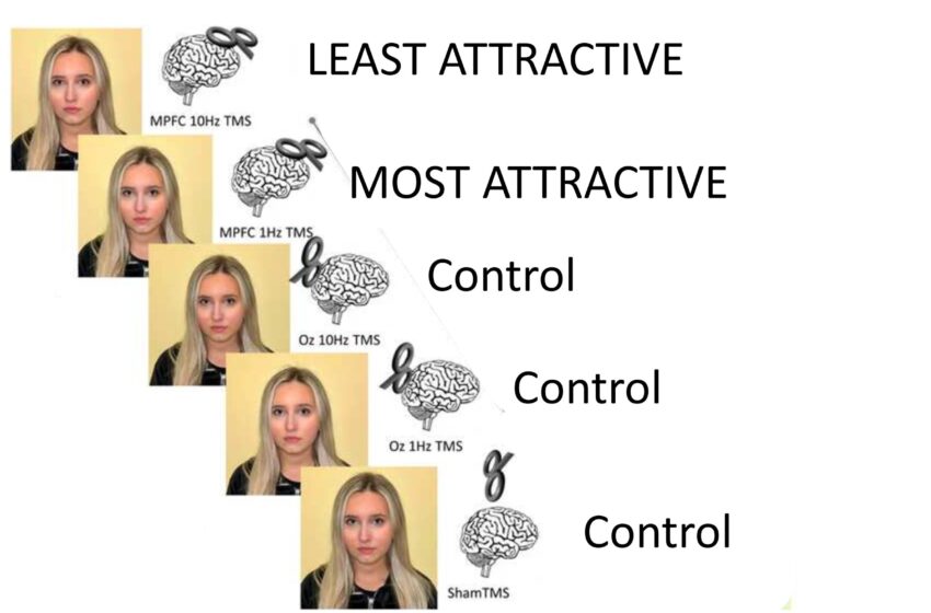  Selon une étude, la stimulation du cortex préfrontal médial modifie l’attractivité perçue d’une personne