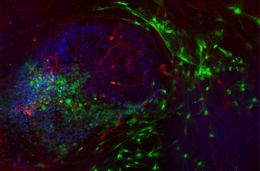  Une avancée importante dans la thérapie par cellules souches pour les maladies intestinales rares