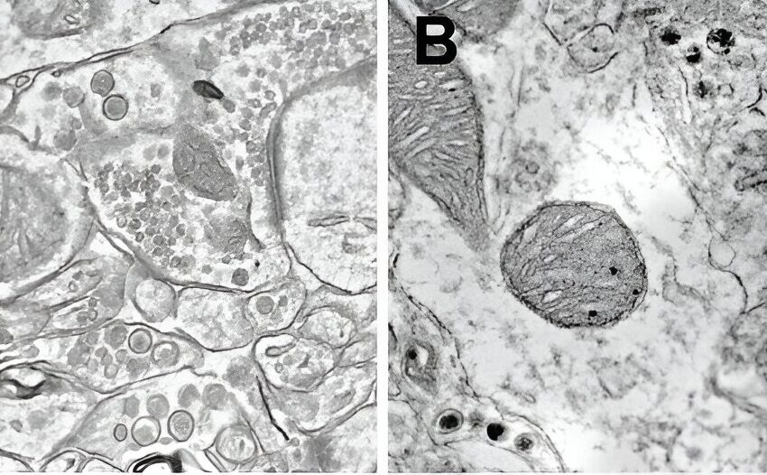  De nouveaux outils révèlent que ce sont les neuropeptides, et non les neurotransmetteurs, qui codent le danger dans le cerveau