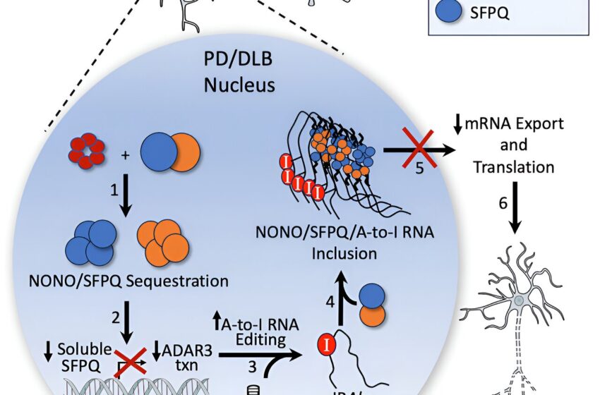  Découverte de nouveaux mécanismes cellulaires dans la maladie de Parkinson