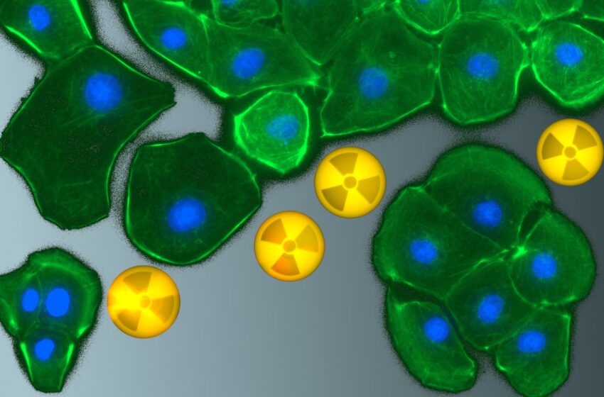  Des chercheurs étudient la manière dont les radionucléides interagissent avec les cellules rénales