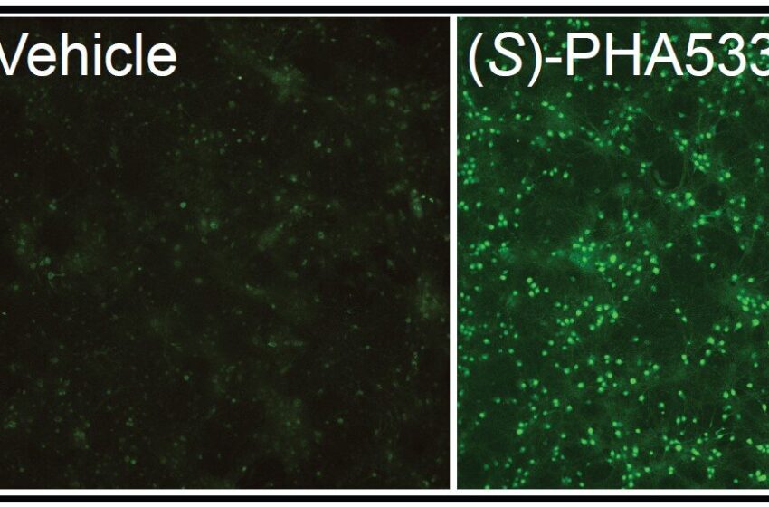  Des chercheurs identifient une molécule comme traitement potentiel du syndrome d’Angelman