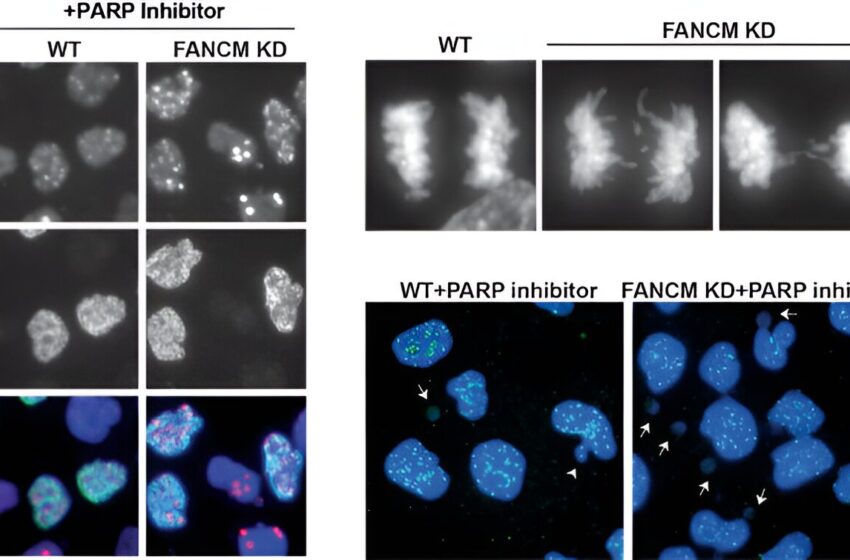  Des chercheurs mettent en lumière la résistance aux médicaments contre le cancer et le potentiel d’étendre l’utilisation des inhibiteurs de PARP à tous les types de cancer