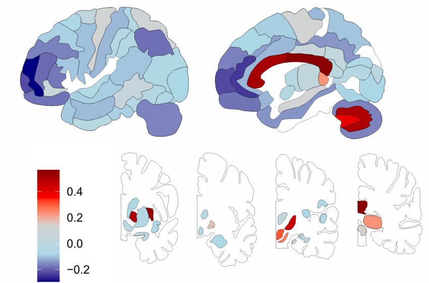  Des scientifiques cartographient la distribution des lipides dans le cerveau humain