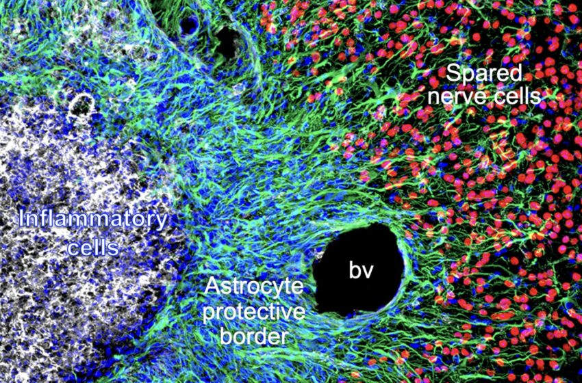  Étude de la façon dont les astrocytes réagissent aux lésions de la moelle épinière ou aux lésions tissulaires provoquées par un accident vasculaire cérébral