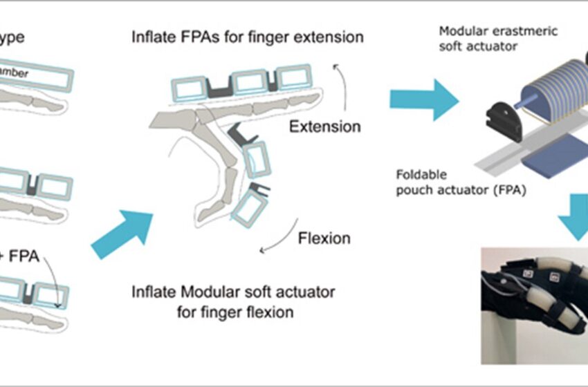  L’actionneur de poche pliable améliore l’extension des doigts dans les gants de rééducation souples
