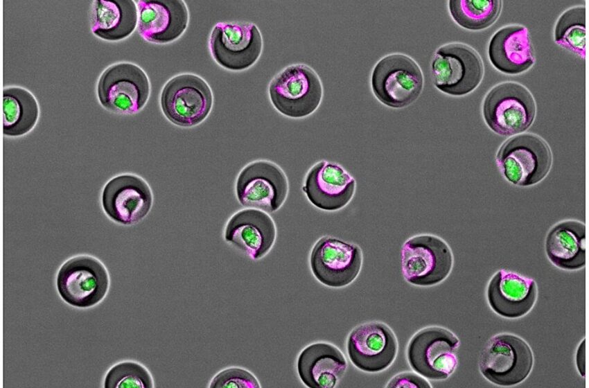  Le tri des cellules souches thérapeutiques par fonction améliore la guérison après une crise cardiaque, selon une étude en laboratoire