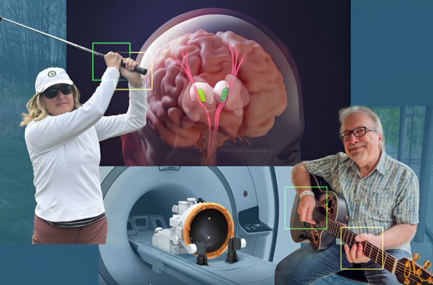  L’échographie focalisée bilatérale s’avère sûre et efficace pour les patients souffrant de tremblement essentiel persistant ou sévère