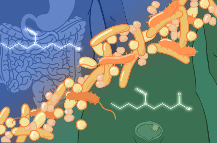  Les microbes intestinaux impliqués dans le cancer de la vessie