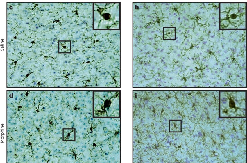  Un antagoniste des récepteurs des neurotransmetteurs cérébraux pourrait prévenir la dépendance aux opioïdes chez la souris