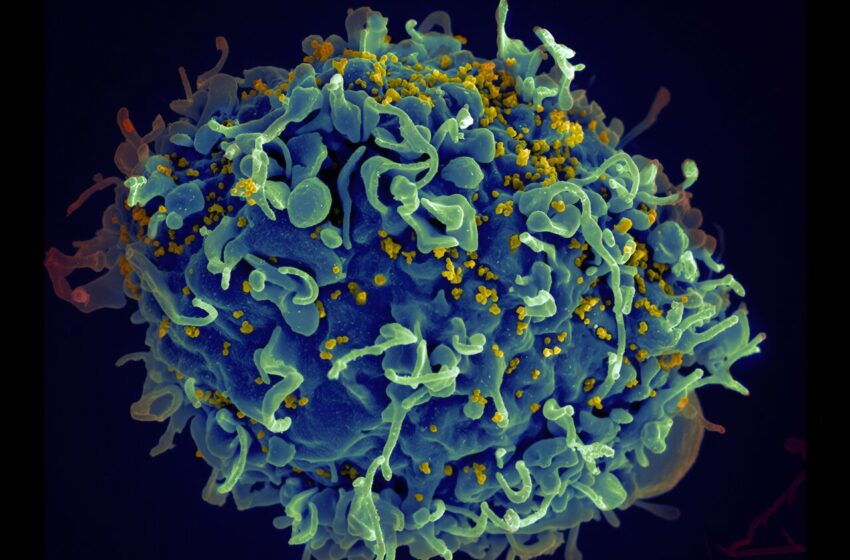  Un nouveau test de laboratoire pour détecter les souches persistantes du VIH en Afrique pourrait aider à la recherche d’un remède