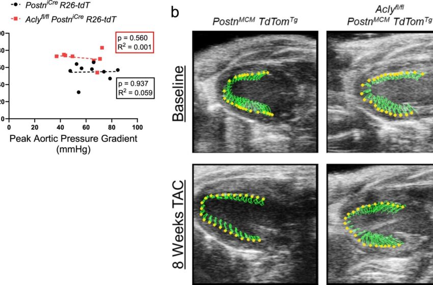  Une étude élucide le mécanisme à l’origine de la fibrose cardiaque, ouvrant la voie à de nouveaux traitements contre l’insuffisance cardiaque