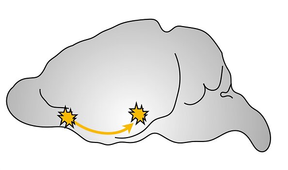  Une étude met en lumière la manière dont le cerveau adapte l’audition dans différentes situations d’écoute