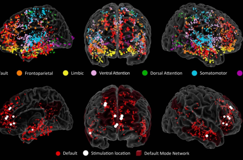  Une étude révèle les origines de la créativité dans le cerveau