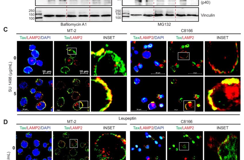  Une nouvelle cible médicamenteuse identifiée pour les maladies associées au virus responsable de la leucémie