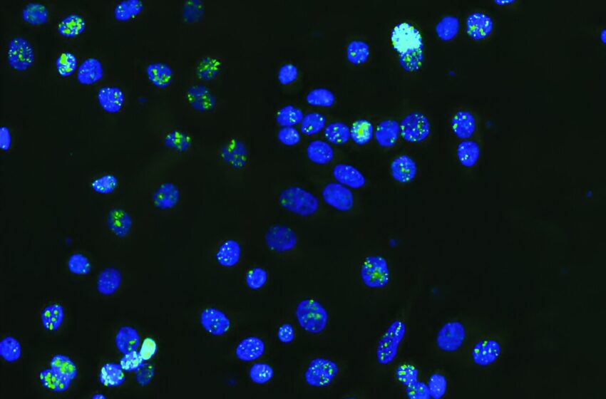  Une nouvelle classe de mutations cancéreuses découverte dans l’ADN dit «poubelle»