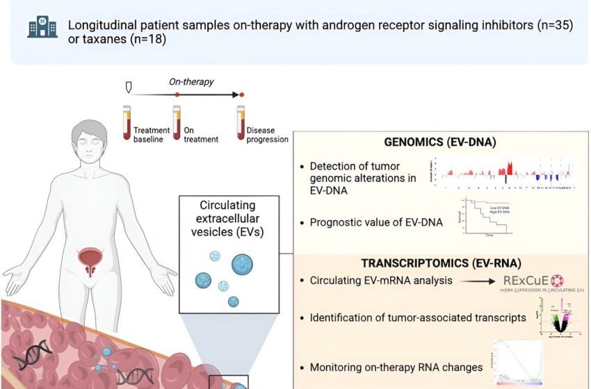  Une nouvelle méthodologie de biopsie liquide permet de surveiller l’évolution de la maladie chez les patients atteints d’un cancer métastatique de la prostate