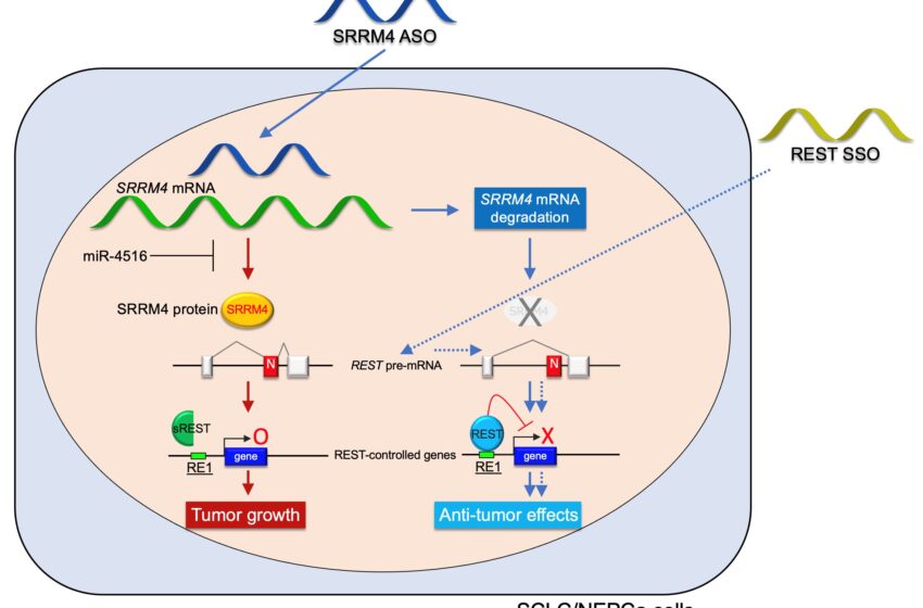  Une stratégie d’épissage de l’ARN corrige le gène suppresseur de tumeur dans les cancers neuroendocrines