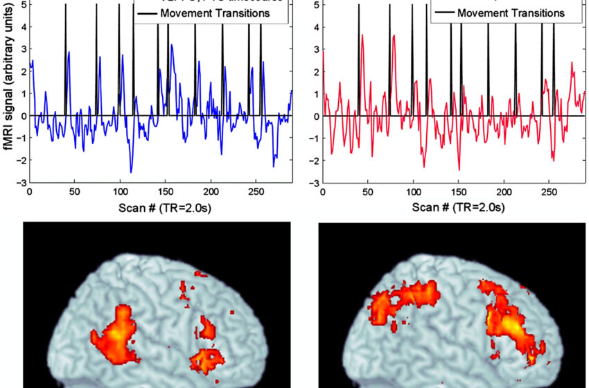  Comment notre cerveau dépasse les frontières musicales