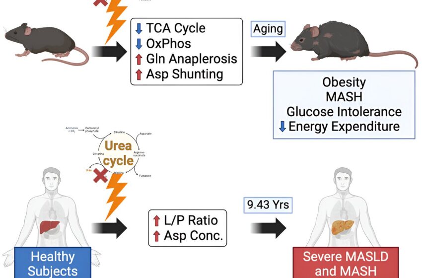 De nouvelles recherches explorent le lien étroit entre le cycle de l’urée et la stéatose hépatique