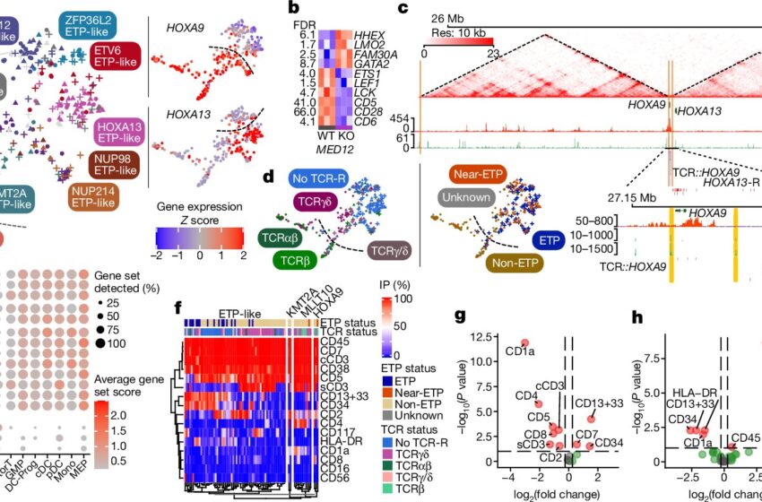  De nouvelles recherches sur le point de transformer l’approche du diagnostic et du traitement de la leucémie aiguë chez les enfants