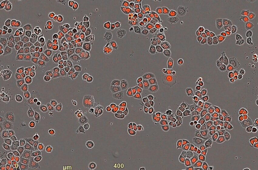  Des chercheurs en cancérologie développent une nouvelle méthode qui utilise l’horloge interne des cellules tumorales pour optimiser les thérapies