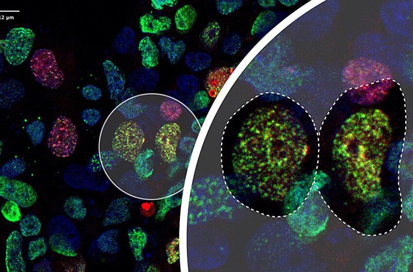  Développer une méthode simple et rentable pour identifier les cibles d’une enzyme cruciale de modification des protéines