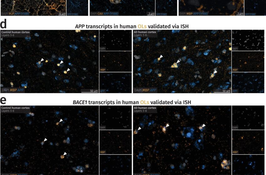  Il n’y a pas que les neurones : les cellules gliales produisent également des protéines nocives