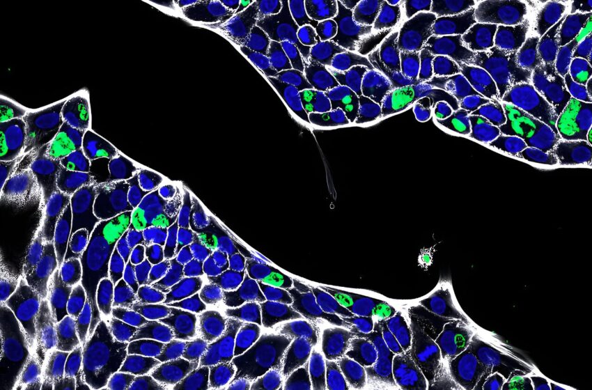  La chlamydia peut s’installer dans l’intestin, révèlent des expériences sur des organoïdes