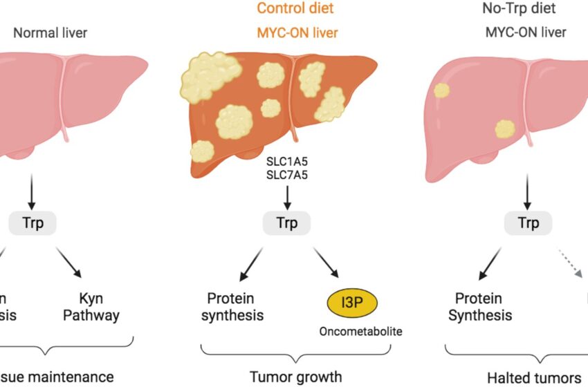  La croissance du cancer du foie liée à la consommation de tryptophane