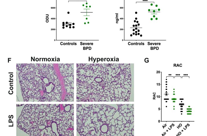  L’inhalation de lactobacilles vivants réduit l’inflammation pulmonaire et améliore la fonction pulmonaire, selon une étude préclinique